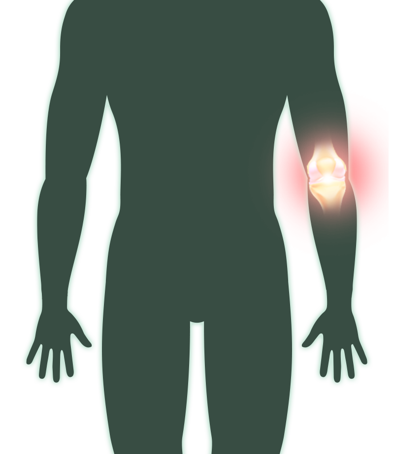 이미지명
