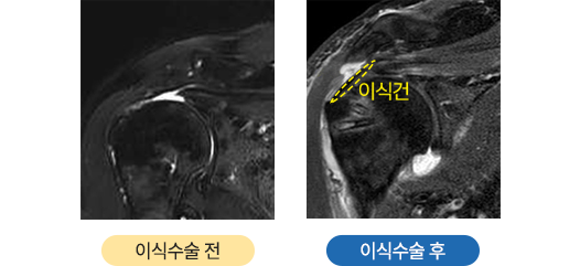 이미지명