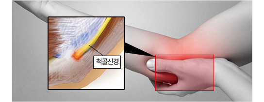 이미지명