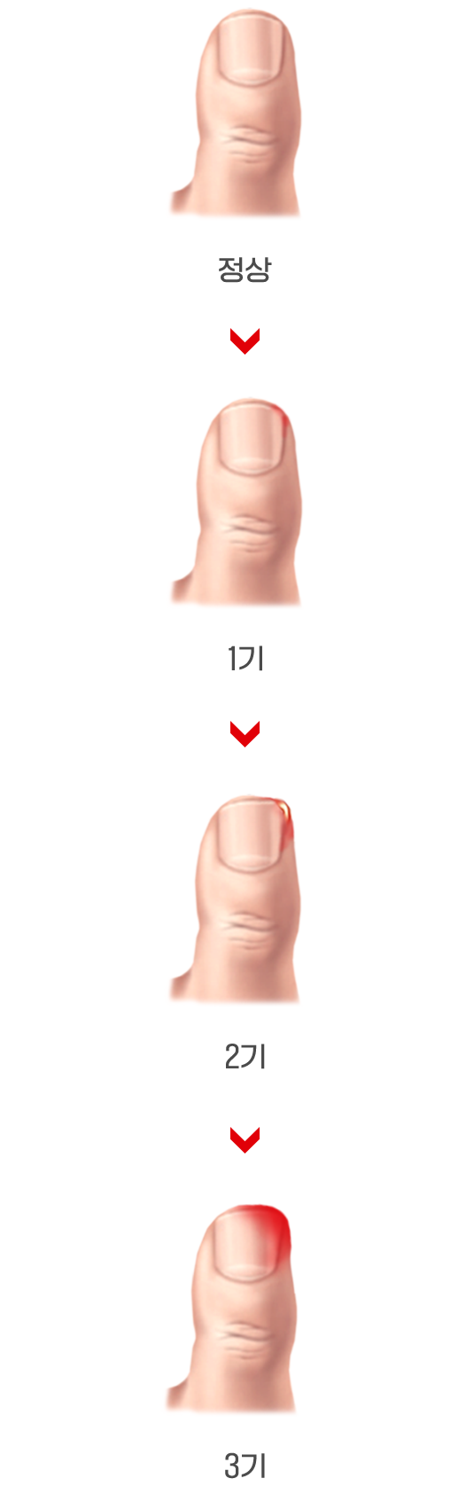이미지명