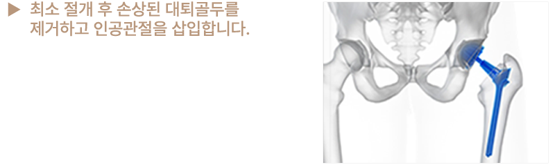 이미지명