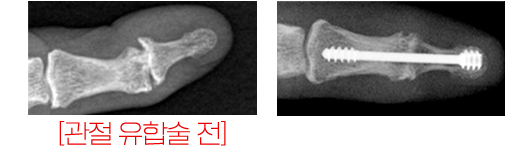 이미지명