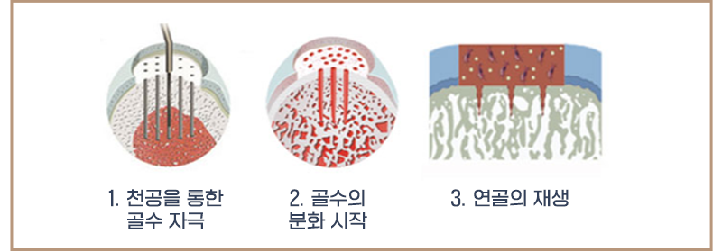 이미지명