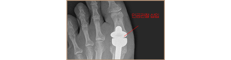 이미지명