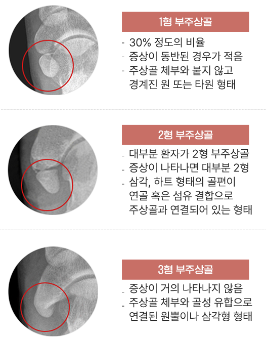이미지명
