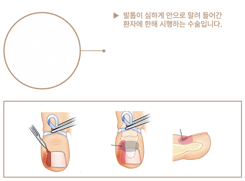 이미지명