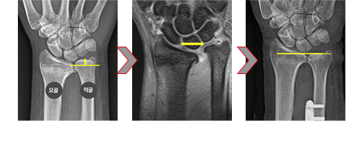 이미지명