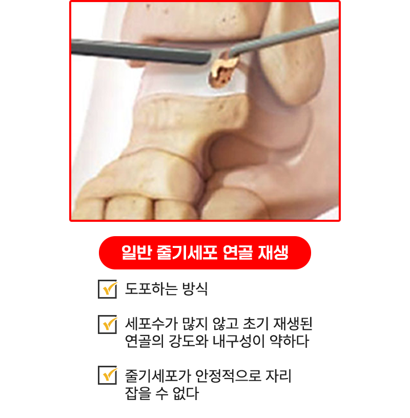 이미지명