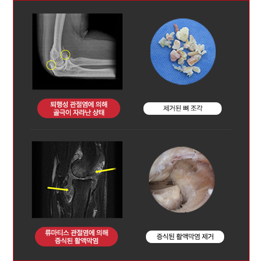 이미지명