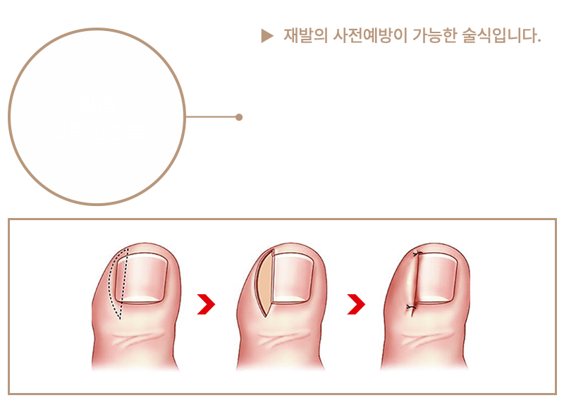 이미지명