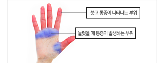 이미지명