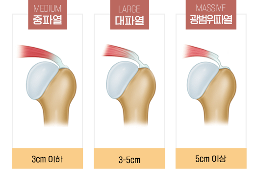 이미지명