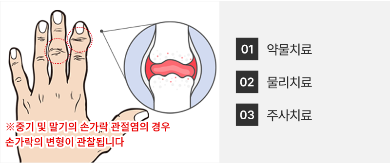 이미지명