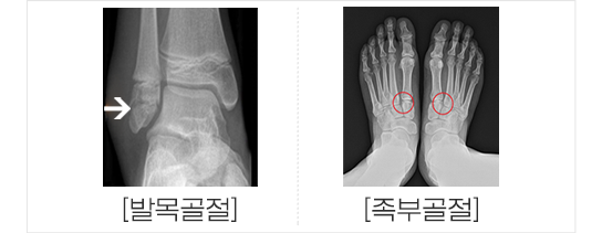 이미지명