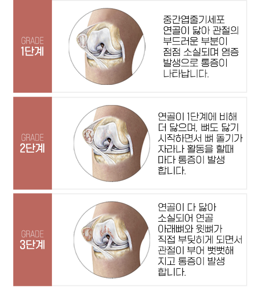 이미지명