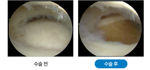 이미지명