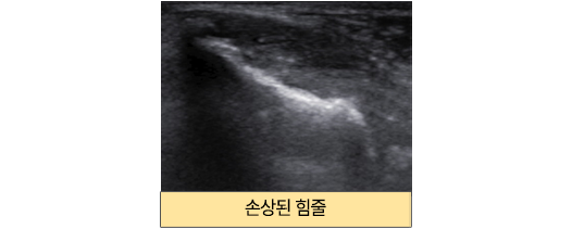 이미지명