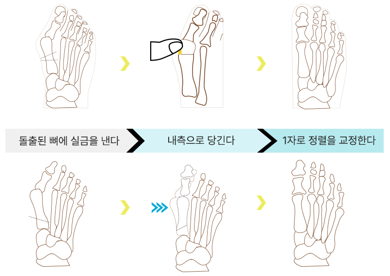 이미지명