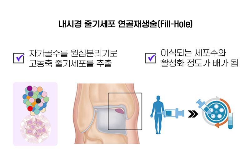 이미지명