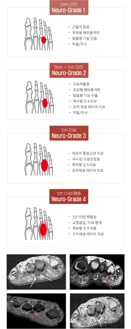 이미지명
