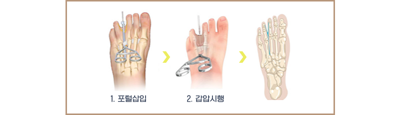 이미지명