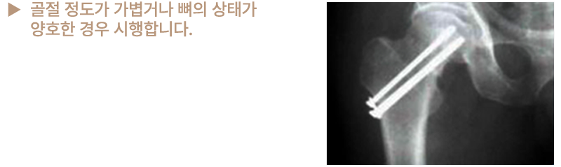이미지명