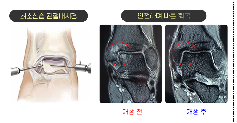 이미지명