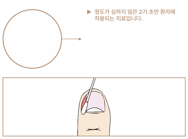 이미지명