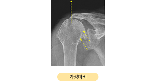 이미지명