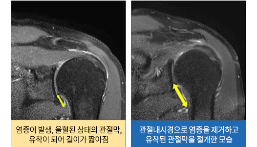 이미지명