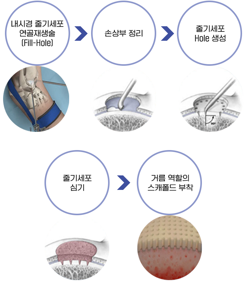 이미지명