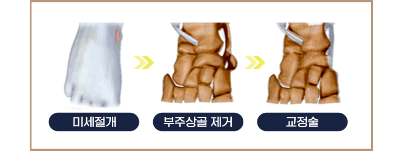 이미지명
