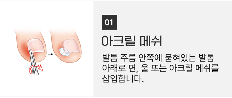 이미지명