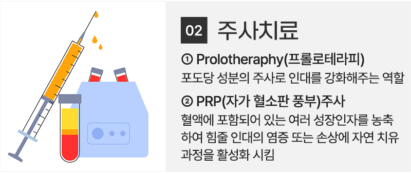 이미지명