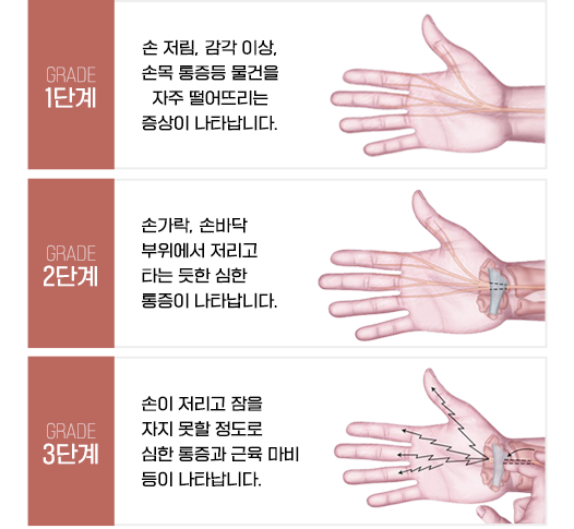 이미지명