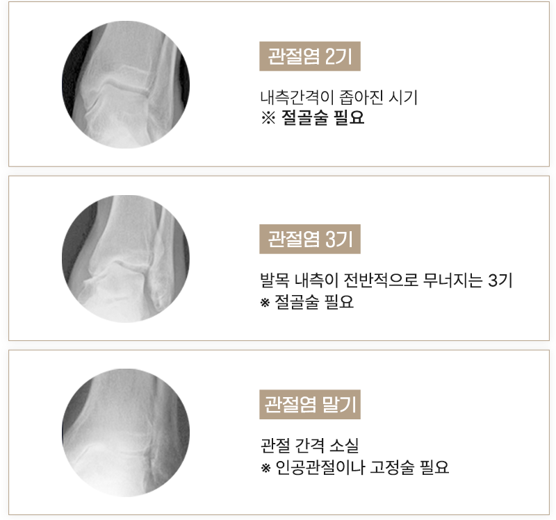 이미지명