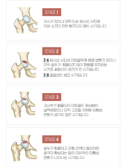 이미지명