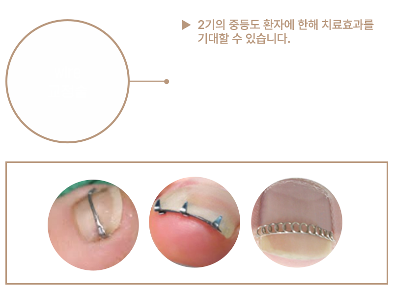 이미지명