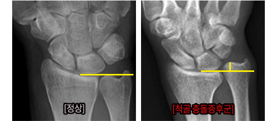 이미지명
