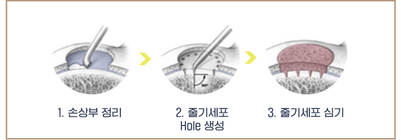 이미지명