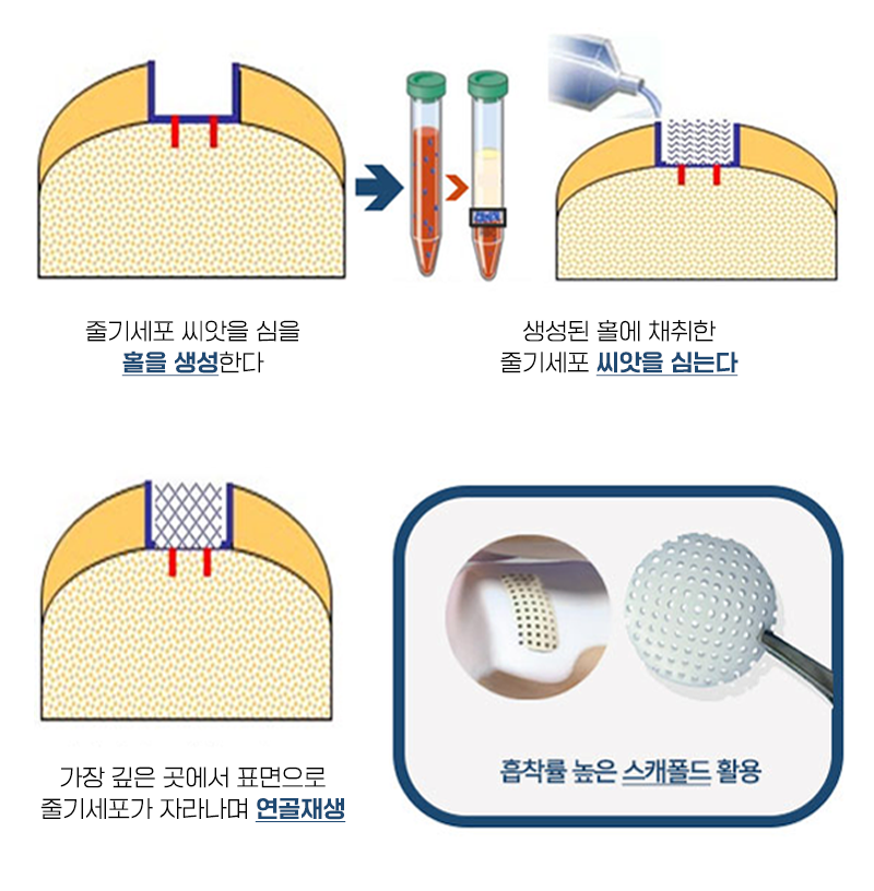 이미지명