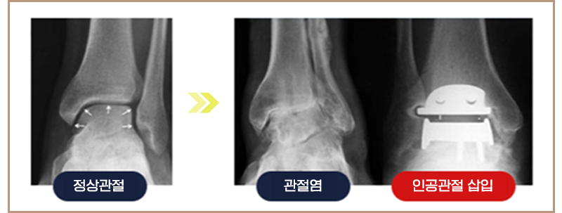 이미지명