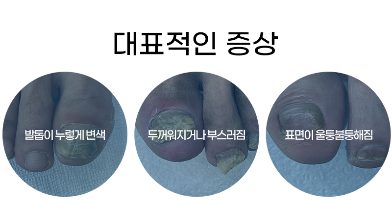 이미지명