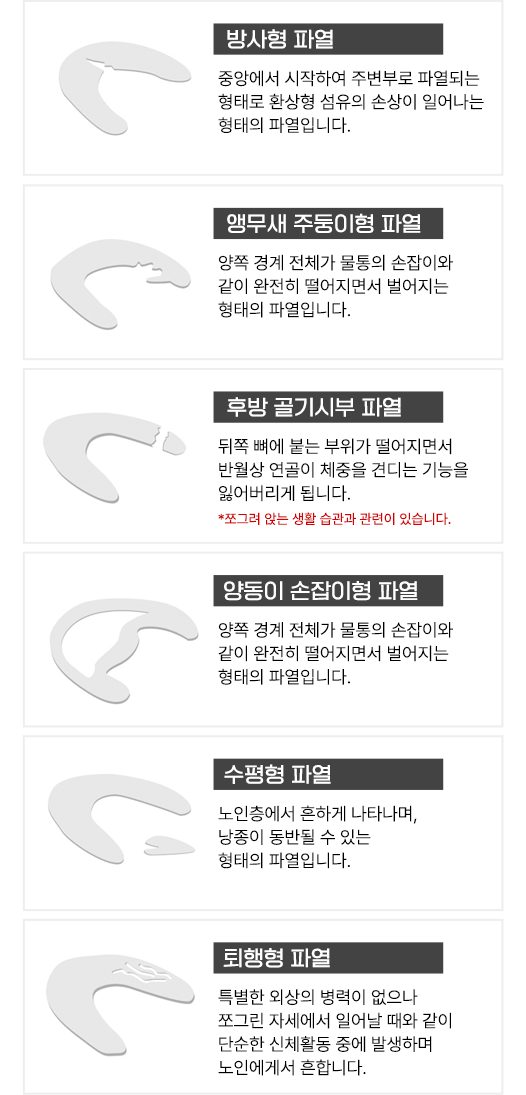 이미지명