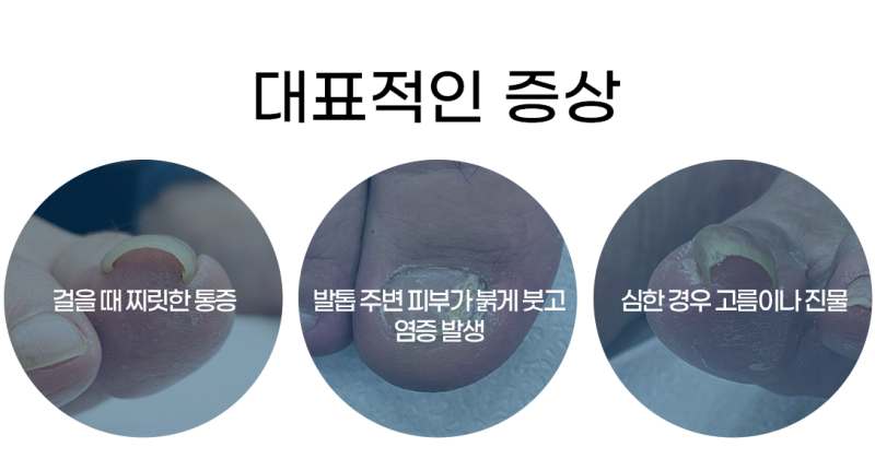 이미지명