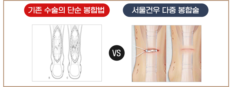 이미지명